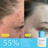 ZIIP Clear Salicylic Acid Serum