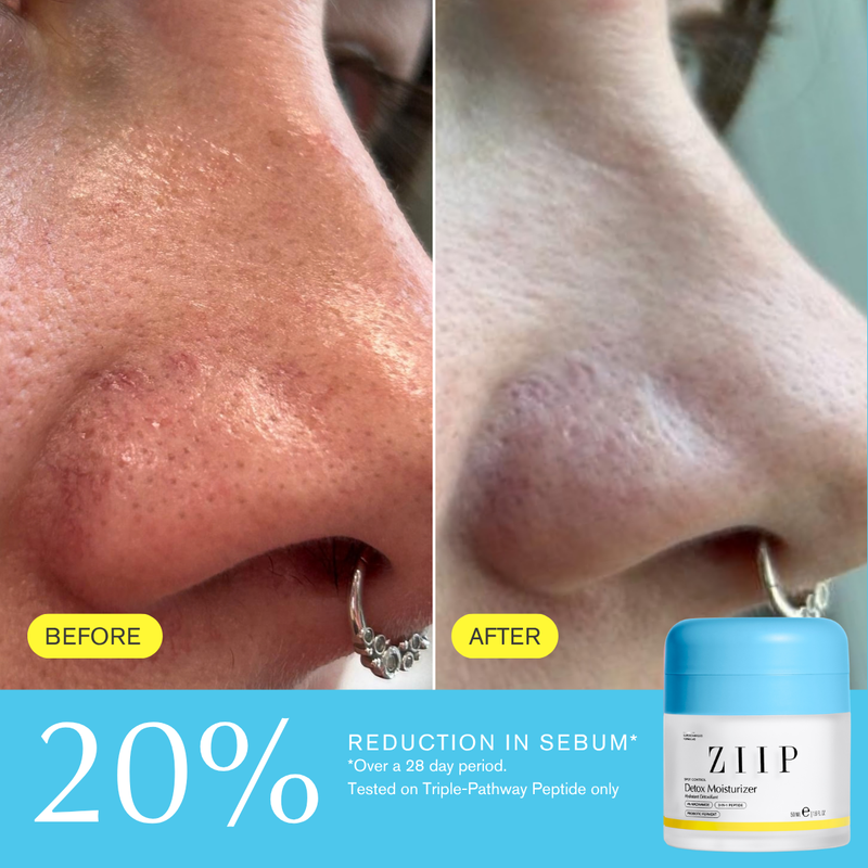 ZIIP Detox Niacinamide Moisturiser