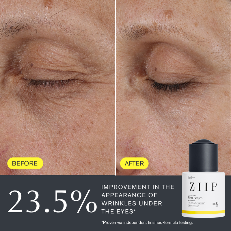 ZIIP Firm Retinol Serum