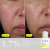 ZIIP Glow AHA + PHA Serum