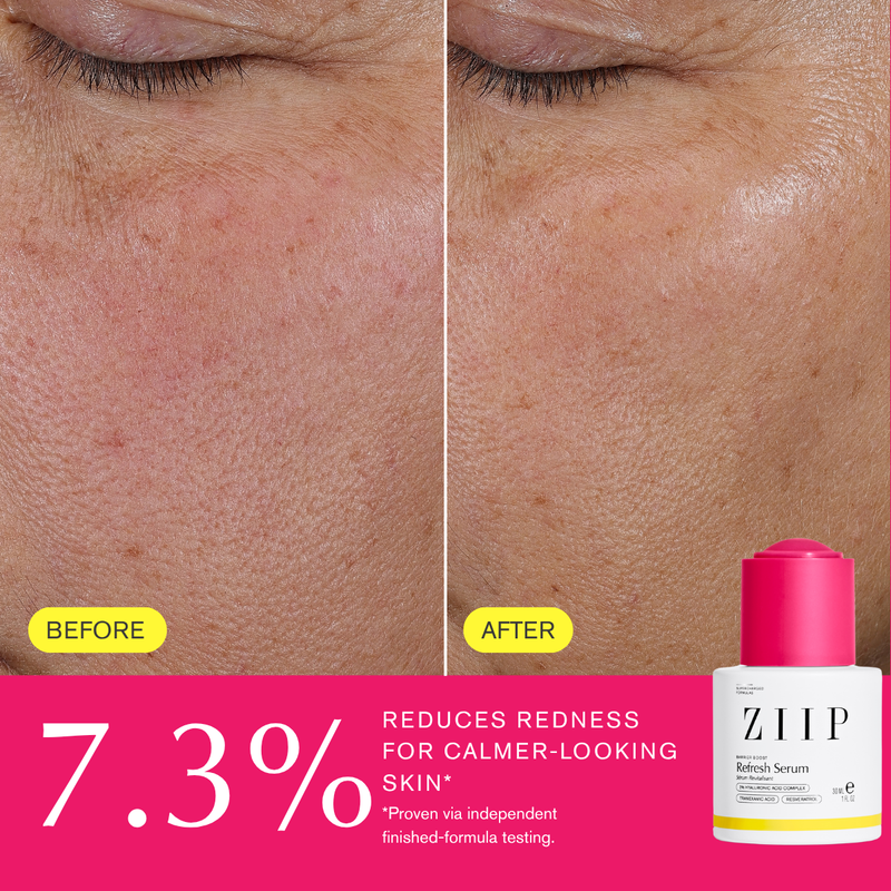 ZIIP Refresh Tranexamic Acid Serum