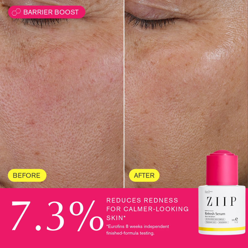 ZIIP Refresh Tranexamic Acid Serum
