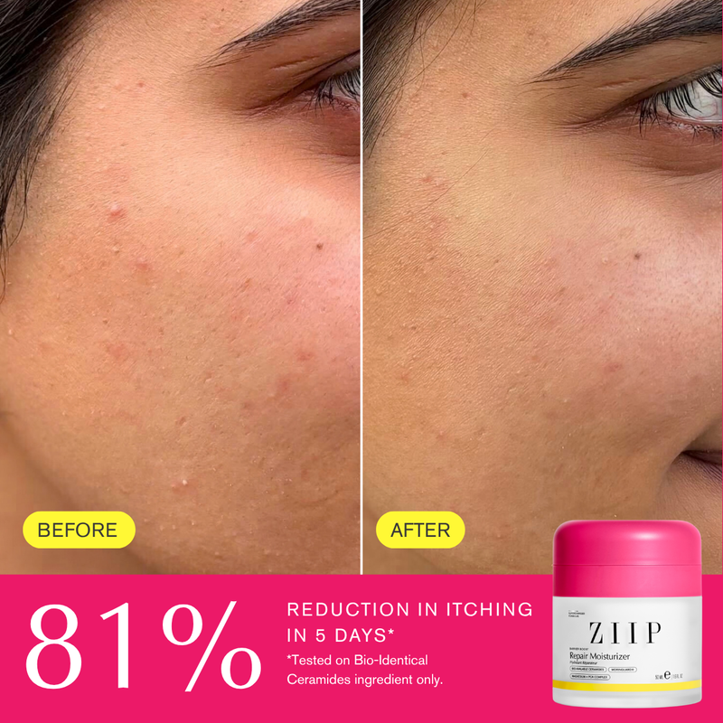 ZIIP Repair Ceramide Moisturiser
