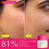 ZIIP Repair Ceramide Moisturiser